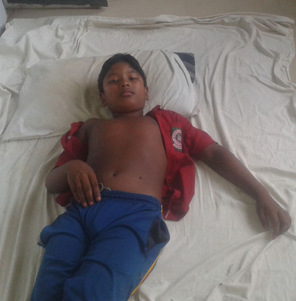 নাটোরের বড়াইগ্রামে ঢিল ছোড়ায় ভাঙ্গা হল শিশুর হাত!