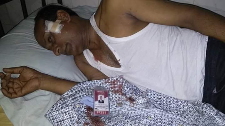 নাটোরের গুরুদাসপুরে দূর্বৃত্তদের হামলায় সাংবাদিক দিল মোহাম্মদ আহত।