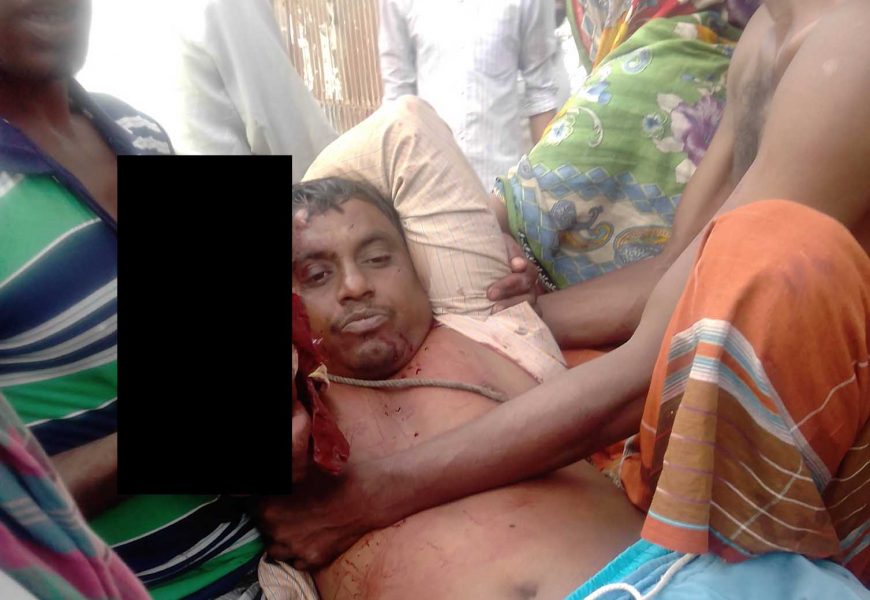 নাটোরের গুরুদাসপুরে কৃষি শ্রমিকের হাত কেটে নিল প্রতিপক্ষ