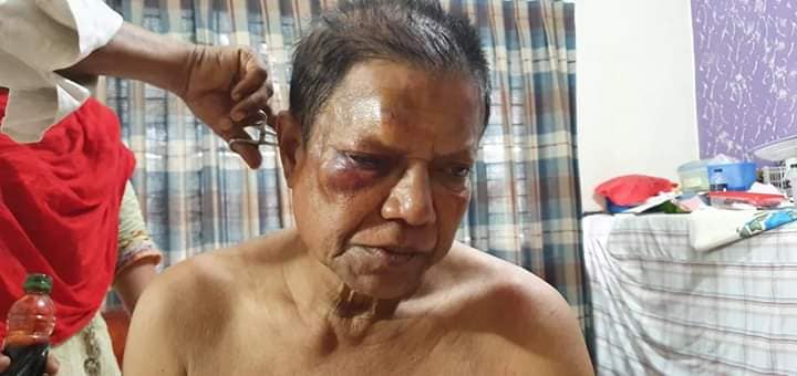 নাটোরে বিএনপি নেতার উপর আ’লীগ কর্মীদের হামলা