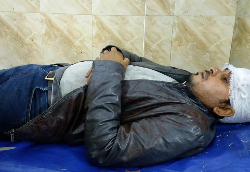 নাটোর হাসপাতালে ট্রেনে পাথর নিক্ষেপে আহত যাত্রীকে ভর্তি