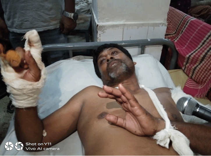 চাঁদা না দেয়ায় ঠিকাদার সজলকে কুপিয়ে জখম চাঁদা না দেয়ায় ঠিকাদার সজলকে কুপিয়ে জখম