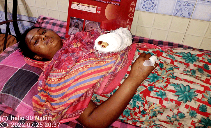 স্বামীর নৃশংসতায় দুই হাতের ৭টি আঙ্গুল হারাতে বসেছে এক গৃহবধু