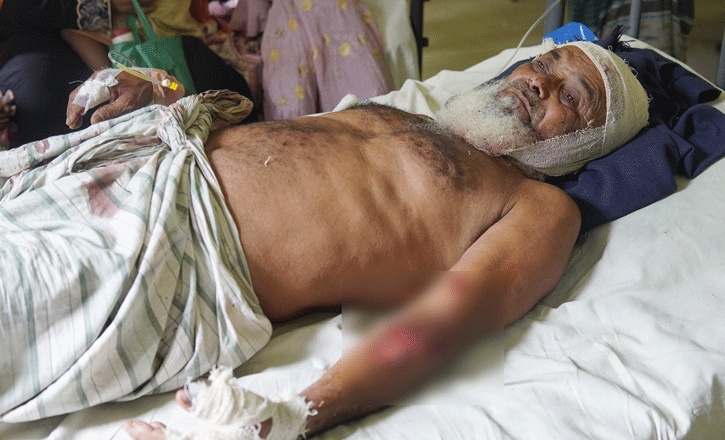 জমি নিয়ে বিরোধের জেরে বড় ভাইকে কুপিয়ে জখম
