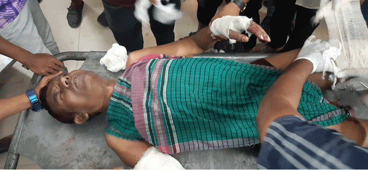 আ’লীগ নেতা ও সাবেক ওয়ার্ড কাউন্সিলর নান্নুকে কুপিয়ে জখম