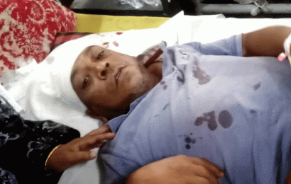 চেয়ারম্যান প্রার্থীর সমর্থকের বাড়িতে মুখোশধারীদের হামলা॥ আহত ১